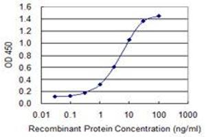 Detection limit for recombinant GST tagged FLNA is 0. (Filamin A 抗体  (AA 1-838))