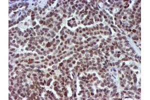 Image no. 6 for anti-Ubiquitin Specific Peptidase 7 (Herpes Virus-Associated) (USP7) antibody (ABIN1498592) (USP7 抗体)