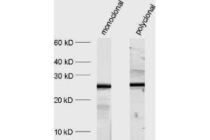 dilution: 1 : 1000, sample: crude synaptosomal fraction of rat brain (P2) (SNAP25 抗体  (AA 192-206))