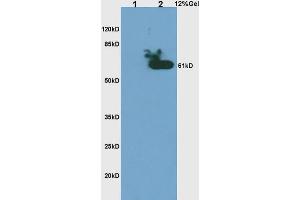 L1 rat brain lysates, L2 human colon carcinoma lysates probed with Anti- Phospho-CHK2(Thr68) Polyclonal Antibody, Unconjugated (ABIN703165) at 1:200 in 4 °C. (CHEK2 抗体  (pThr68))