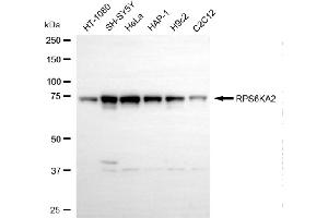 anti-Ribosomal Protein S6 Kinase, 90kDa, Polypeptide 2 (RPS6KA2) antibody