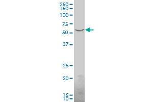 PNKP polyclonal antibody (A01), Lot # 051017JC01.