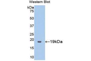 Western Blotting (WB) image for anti-Thrombomodulin (THBD) (AA 325-481) antibody (ABIN1173036) (Thrombomodulin 抗体  (AA 325-481))