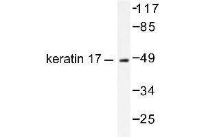 Image no. 1 for anti-Keratin 17 (KRT17) antibody (ABIN265496) (KRT17 抗体)