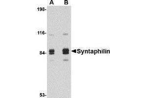 Western Blotting (WB) image for anti-Syntaphilin (SNPH) (Middle Region) antibody (ABIN1031114) (Syntaphilin 抗体  (Middle Region))