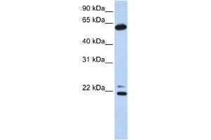 WB Suggested Anti-CCT5 Antibody Titration: 0. (CCT5 抗体  (C-Term))