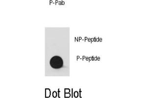 Dot Blot (DB) image for anti-V-Yes-1 Yamaguchi Sarcoma Viral Oncogene Homolog 1 (YES1) (pTyr530), (pTyr537) antibody (ABIN2970974) (YES1 抗体  (pTyr530, pTyr537))