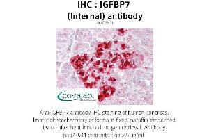 Image no. 1 for anti-Insulin-Like Growth Factor Binding Protein 7 (IGFBP7) (Internal Region) antibody (ABIN1735789) (IGFBP7 抗体  (Internal Region))
