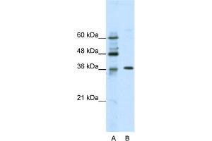 WB Suggested Anti-ZNF124 Antibody Titration:  2. (ZNF124 抗体  (N-Term))