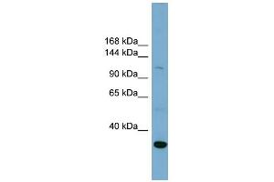 WB Suggested Anti-SLC9A1 Antibody Titration:  0. (SLC9A1 抗体  (Middle Region))