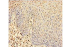 Immunohistochemistry of paraffin-embedded human tonsil tissue using ABIN7144104 at dilution of 1:100 (ANGPTL2 抗体  (AA 23-493))