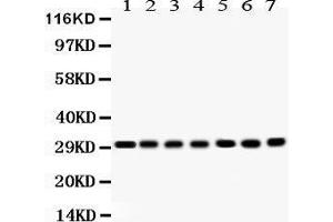 Western Blotting (WB) image for anti-Catechol-O-Methyltransferase (COMT) (AA 52-271) antibody (ABIN3043815) (COMT 抗体  (AA 52-271))