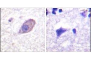 Immunohistochemistry (IHC) image for anti-Potassium Inwardly-Rectifying Channel, Subfamily J, Member 16 (KCNJ16) (AA 369-418) antibody (ABIN1532704)