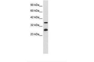 Image no. 1 for anti-Metal Response Element Binding Transcription Factor 2 (MTF2) (AA 26-75) antibody (ABIN6736029) (MTF2 抗体  (AA 26-75))