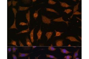 Immunofluorescence analysis of L929 cells using PDE6D Polyclonal Antibody at dilution of 1:100 (40x lens). (PDE6D 抗体)