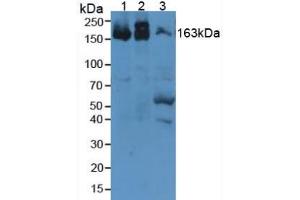 Figure. (alpha 2 Macroglobulin 抗体  (AA 1053-1214))