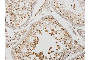 Immunoperoxidase of purified MaxPab antibody to DYX1C1 on formalin-fixed paraffin-embedded human testis. (DYX1C1 抗体  (AA 1-381))
