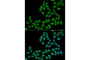 Immunofluorescence analysis of A549 cells using ELF1 antibody (ABIN5974153). (ELF1 抗体)
