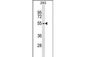 ZBTB6 Antibody (C-term) (ABIN1537261 and ABIN2849293) western blot analysis in 293 cell line lysates (35 μg/lane). (ZBTB6 抗体  (C-Term))
