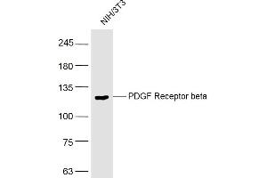 Image no. 5 for anti-Platelet Derived Growth Factor Receptor beta (PDGFRB) (AA 981-1066) antibody (ABIN726635)