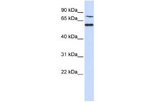 Western Blotting (WB) image for anti-POC1 Centriolar Protein Homolog B (POC1B) antibody (ABIN2459940) (POC1B 抗体)