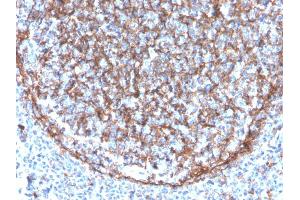 Formalin-fixed, paraffin-embedded human tonsil stained with CD11b Monospecific Mouse Monoclonal Antibody (ITGAM/3340). (CD11b 抗体  (AA 941-1074))
