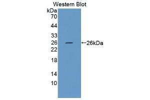 Western blot analysis of the recombinant protein. (FPGT 抗体  (AA 314-513))