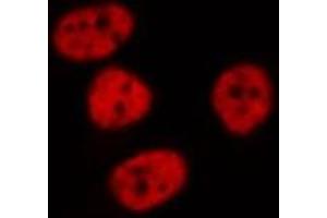 ABIN6268842 staining HeLa cells by IF/ICC. (MGMT 抗体  (N-Term))
