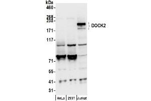 anti-Dedicator of Cytokinesis 2 (DOCK2) (AA 1775-1825) antibody