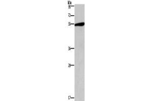 Western Blotting (WB) image for anti-5-Hydroxytryptamine (serotonin) Receptor 2C (HTR2C) antibody (ABIN2432627)