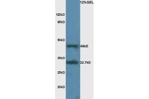 Mouse brain lysate probed with Rabbit Anti-LAMR1 Polyclonal Antibody, Unconjugated  at 1:3000 for 90 min at 37˚C. (RPSA/Laminin Receptor 抗体  (AA 101-200))