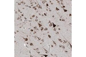 Immunohistochemical staining of human cerebral cortex with C2orf30 polyclonal antibody  shows cytoplasmic positivity in neuronal cells. (C2orf30 抗体)