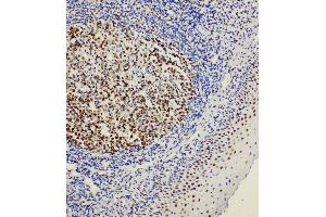 Immunohistochemistry (IHC) image for anti-POU Class 2 Associating Factor 1 (POU2AF1) (AA 238-256), (C-Term) antibody (ABIN3044424)