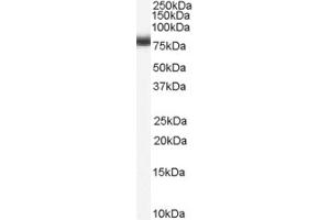 Western Blotting (WB) image for anti-Numb Homolog (NUMB) (C-Term) antibody (ABIN2465260) (NUMB 抗体  (C-Term))