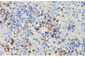 Immunohistochemistry of paraffin-embedded Rat spleen using DUT Polyclonal Antibody at dilution of 1:100 (40x lens). (Deoxyuridine Triphosphatase (DUT) 抗体)