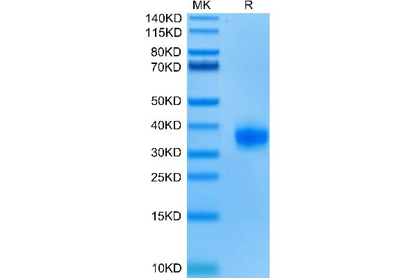 ULBP2 Protein (His-Avi Tag,Biotin)