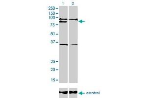 Western Blotting (WB) image for anti-Ring Finger Protein 141 (RNF141) (AA 141-230) antibody (ABIN599236) (RNF141 抗体  (AA 141-230))
