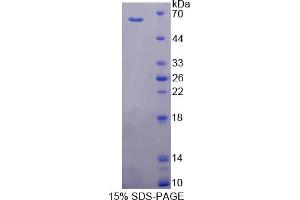 Image no. 1 for Cytochrome P450, Family 11, Subfamily B, Polypeptide 1 (CYP11B1) (AA 1-498) protein (His tag) (ABIN6236997)