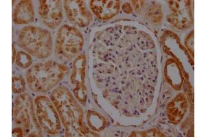 IHC image of ABIN7127803 diluted at 1:100 and staining in paraffin-embedded human kidney tissue performed on a Leica BondTM system. (Recombinant SDHB 抗体)