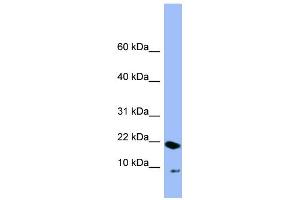 WB Suggested Anti-PIN4 Antibody Titration: 0. (PIN4 抗体  (N-Term))