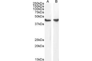 Western Blotting (WB) image for anti-Actin, alpha 2, Smooth Muscle, Aorta (ACTA2) (N-Term) antibody (ABIN185271)