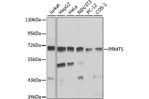 Western blot analysis of extracts of various cell lines, using PRMT5 antibody (ABIN3022065, ABIN3022066, ABIN3022067 and ABIN6218592) at 1:1000 dilution. (PRMT5 抗体  (AA 40-140))