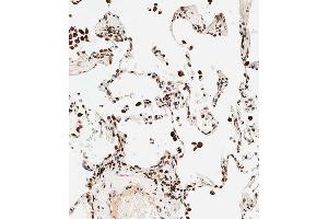 Immunohistochemical analysis of paraffin-embedded human lung tissue using B performed on the Leica® BOND RXm. (STRA8 抗体  (C-Term))
