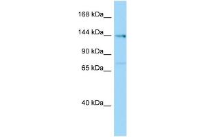 Host:  Rabbit  Target Name:  Plekha6  Sample Type:  Rat Testis lysates  Antibody Dilution:  1. (PLEKHA6 抗体  (Middle Region))