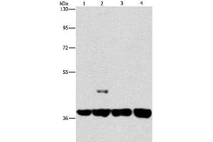 Western Blot analysis of 293T and 231 cell, U937 and Raji cell using SERPINA9 Polyclonal Antibody at dilution of 1:350 (SERPINA9 抗体)