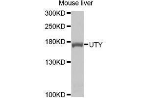 Western blot analysis of extracts of mouse liver cells, using UTY antibody. (UTY 抗体)