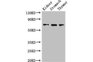 Western Blot Positive WB detected in: Mouse kidney tissue, Mouse stomach tissue, Mouse thymus tissue All lanes: COL4A3BP antibody at 3. (COL4A3BP 抗体  (AA 201-500))