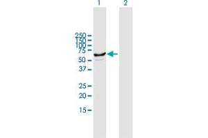 Western Blot analysis of CYP2J2 expression in transfected 293T cell line by CYP2J2 MaxPab polyclonal antibody. (CYP2J2 抗体  (AA 1-502))