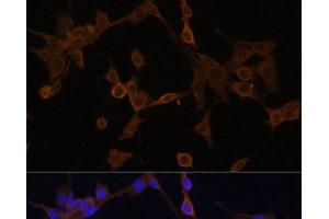 Immunofluorescence analysis of NIH/3T3 cells using BID Polyclonal Antibody at dilution of 1:100. (BID 抗体)