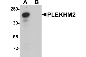 Western Blotting (WB) image for anti-Pleckstrin Homology Domain Containing, Family M (With RUN Domain) Member 2 (PLEKHM2) (C-Term) antibody (ABIN1030591)